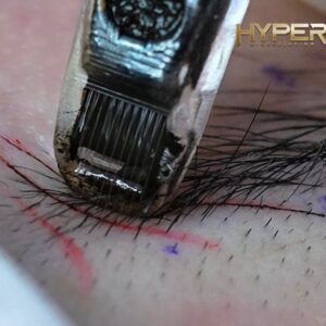Hyper Microblading
